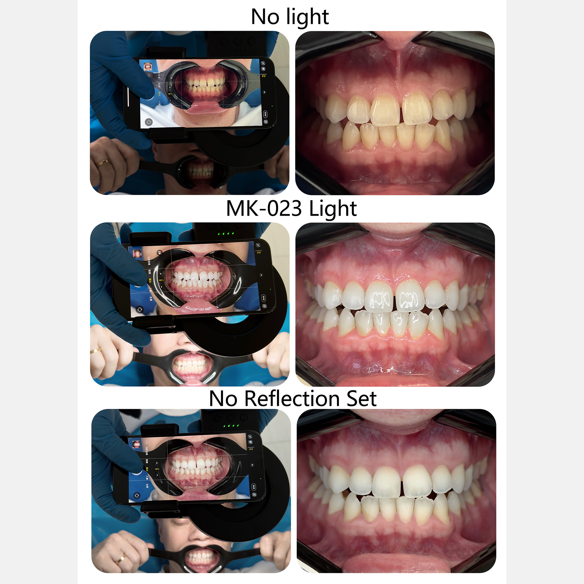 HERA MK-23 Intraoral Dental Ph – обзор и цена Photography Dental