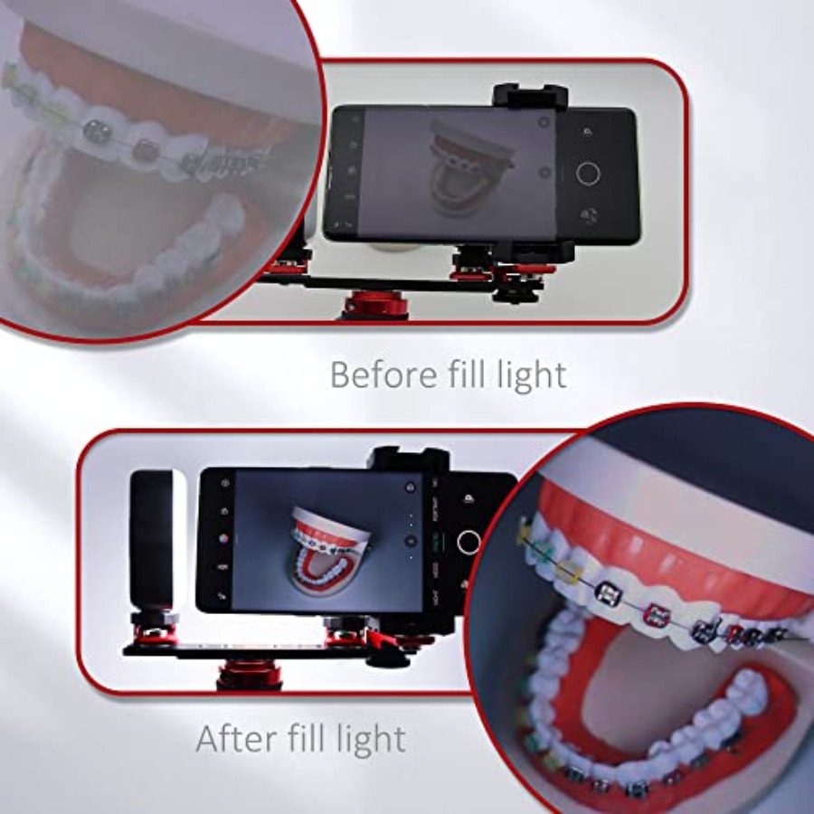 Bluetooth Dental Flash Light P – обзор и цена Photography Dental