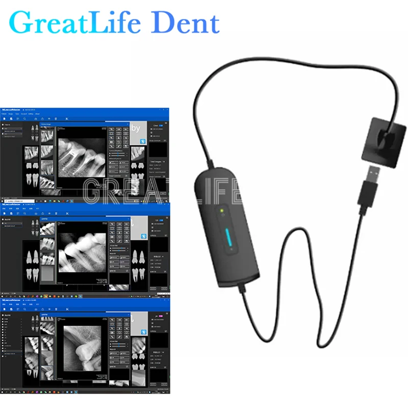 Mexico RU EU ES SA IT In Stock – обзор и цена Photography Dental