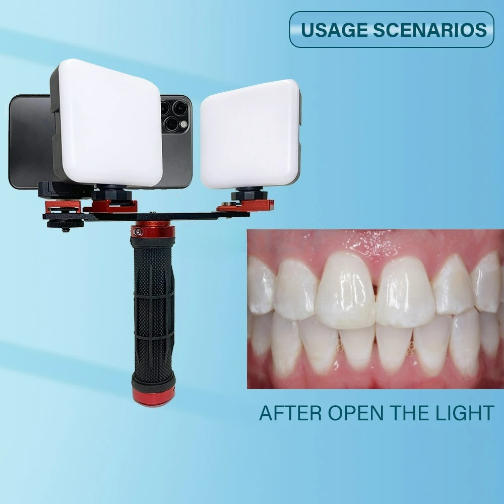 Dental Photography Light Phone – обзор и цена Photography Dental