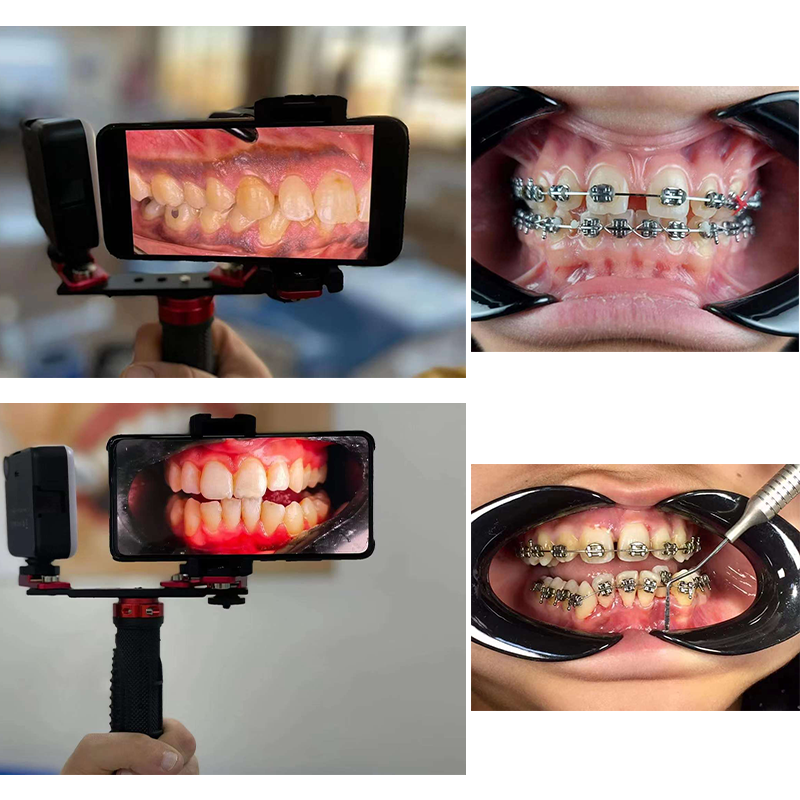 Dentistry Material Mobile Phon – обзор и цена Photography Dental