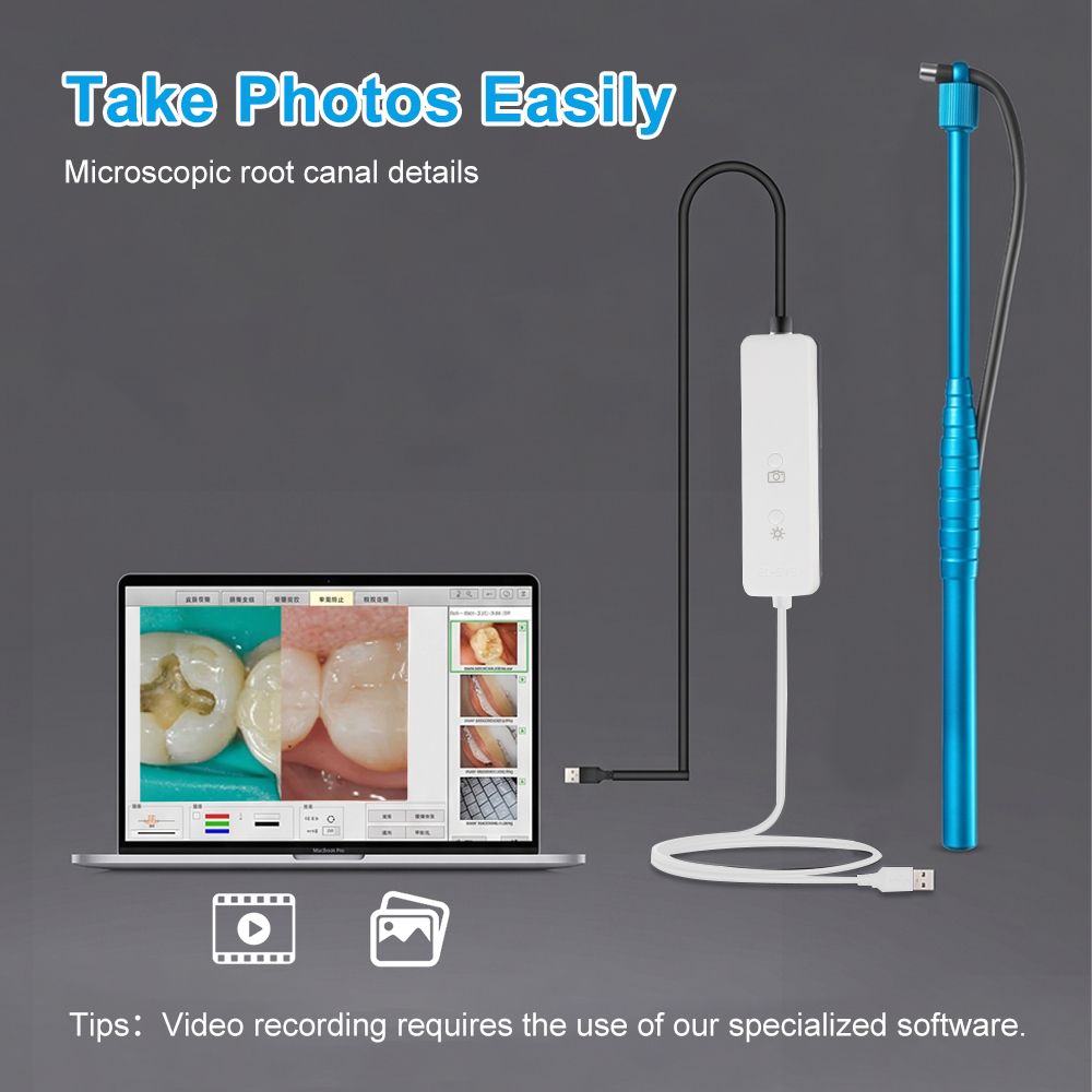 5MP Micro Intraoral Camera Den – обзор и цена Photography Dental