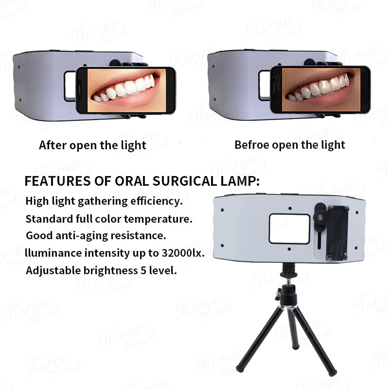 Dental Flash Light Photography – обзор и цена Photography Dental