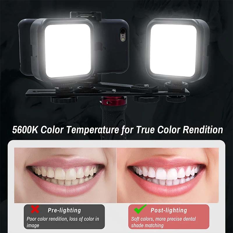 Dental Photography Light With  – обзор и цена Photography Dental